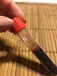 贴砖最好的大铲子品牌全解析